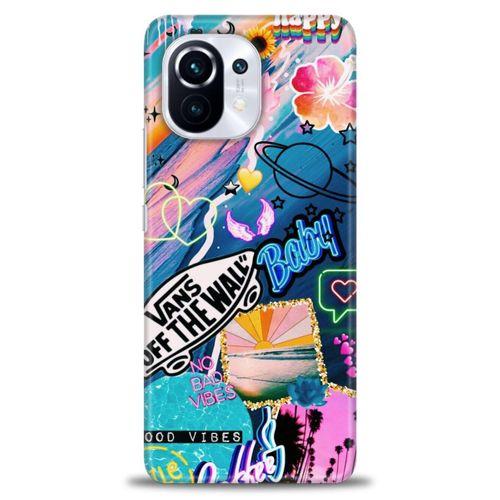 Xiaomi Mi 11 Kılıf HD Baskılı Kılıf - Baby + Tam Ekran Koruyucu