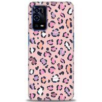 Oppo A55 Kılıf HD Baskılı Kılıf - Pembe Leopar + Tam Ekran Koruyucu