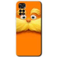 Redmi Note 11 Pro 5G Kılıf HD Desen Baskılı Arka Kapak - Garfield + Kırılmaz Cam