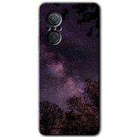 Huawei Nova 9 SE HD Baskılı Kılıf + 9D Tam Ekran Koruyucu - Gece Galaksi