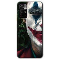 Xiaomi Poco M4 Pro 5G HD Baskılı Kılıf + 9D Tam Ekran Koruyucu - Joker
