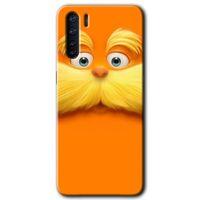 OPPO Oppo A91 Kılıf HD Desen Baskılı Arka Kapak - Garfield