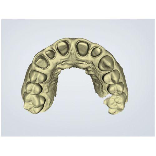 05 El Ments Köprüsü Tam Zirkon (Bu ürün Sadece Plastik parçadır - Almadan Önce Soru Sorabilirsiniz)