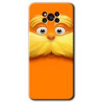 MRCİLETİSİM Poco x3 NFC Kılıf Kapak - Garfield +Hayalet Ekran Yandan Gözükmez
