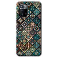Poco x3 GT Kılıf HD Desen Baskılı Arka Kapak + Temperli Cam - Mandala Desen