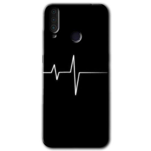 Potkal Hediye Fabrikası General Mobile GM 10 Kılıf HD Desen Baskılı Arka Kapak - Heart Rytm
