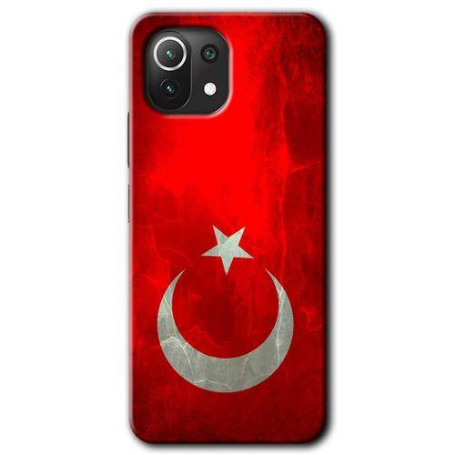 Xiaomi Mi 11 Lite Kılıf Baskılı Arka Kapak - Albayrak +Tam Ekran Koruyucu