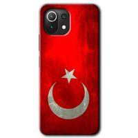 Xiaomi Mi 11 Lite Kılıf Baskılı Arka Kapak - Albayrak +Tam Ekran Koruyucu