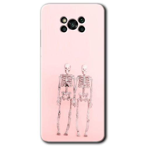 Poco x3 NFC Kılıf Baskılı Kapak - Yaşayan Çift + 5D Tam Kaplayan Cam