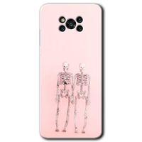 Poco x3 NFC Kılıf Baskılı Kapak - Yaşayan Çift + 5D Tam Kaplayan Cam