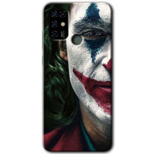 Casper Via F20 Kılıf HD Desen Baskılı Arka Kapak - Joker