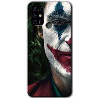 Casper Via F20 Kılıf HD Desen Baskılı Arka Kapak - Joker