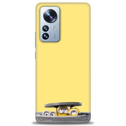 Xiaomi Mi 11 Ultra Kılıf HD Baskılı Kılıf - Lögar + Tam Ekran Koruyucu