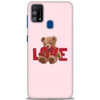 Samsung Galaxy M31 Kılıf HD Baskılı Kılıf - Love Bear + Tam Ekran Koruyucu