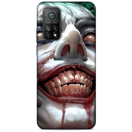 Xiaomi Mi 10T Pro 5G Uyumlu Kılıf Joker (25) Antişok Kapak Barut