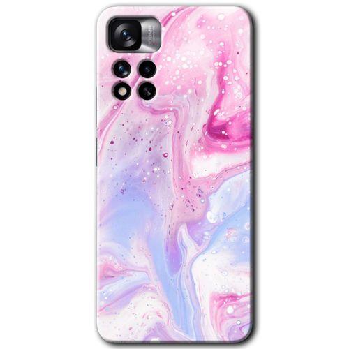 Redmi Note 11 Pro Plus 5G Kılıf HD Desen Baskılı Arka Kapak - Kabarmış Leke + Kırılmaz Cam