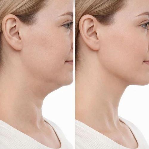 Lenfatik Drenaj Masaj Fırçası