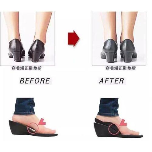 Eğitici Oyuncak Esnek Düz Taban Düzeltici Topuk Yastığı