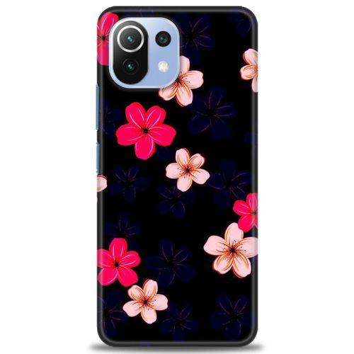 Xiaomi Mi 11 Lite Kılıf HD Baskılı Kılıf - Pembe Mavi Çiçekler + Tam Ekran Koruyucu