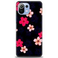 Xiaomi Mi 11 Lite Kılıf HD Baskılı Kılıf - Pembe Mavi Çiçekler + Tam Ekran Koruyucu