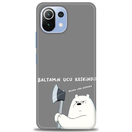 Xiaomi Mi 11 Lite Kılıf HD Baskılı Kılıf - Baltamın Ucu Keskindir + Tam Ekran Koruyucu