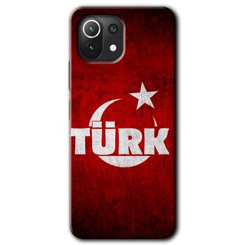 Xiaomi Mi 11 Kılıf HD Desen Baskılı Arka Kapak - Ayyıldız Türk + Kırılmaz Cam