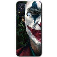 Omix X400 Kılıf HD Desen Baskılı Arka Kapak - Joker