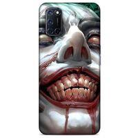 Oppo A52 Uyumlu Kılıf Joker (25) Antişok Kapak Barut