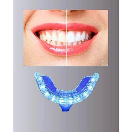 Beyazlatma Kalemli Led Diş Parlatma Seti