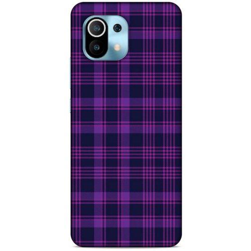 Xiaomi Redmi K30 Pro Uyumlu Kılıf Mor Delisi (10) Full Koruma Kılıfı Ekose