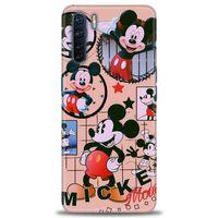 Oppo A91 / Reno 3 Kılıf HD Baskılı Kılıf - Mickey Mouse + Tam Ekran Koruyucu