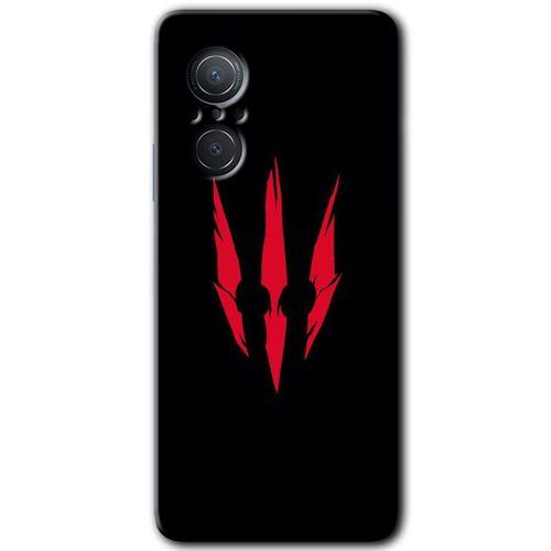 Potkal Hediye Fabrikası Huawei Nova 9 SE Kılıf HD Desen Baskılı Arka Kapak - Ayı Pençesi