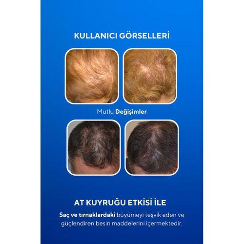 Vita Ceel Hair and Nail Gummies 60 Gummies