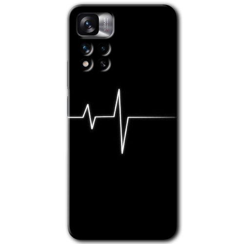 Potkal Hediye Fabrikası Xiaomi Redmi Note 11 Pro Plus 5G Kılıf HD Desen Baskılı Arka Kapak - Flash Logo