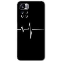 Xiaomi Redmi Note 11 Pro Plus 5G HD Baskılı Kılıf + 9D Tam Ekran Koruyucu - Heart Rytm