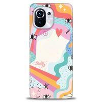 Xiaomi Mi 11 Kılıf HD Baskılı Kılıf - Almost + Tam Ekran Koruyucu