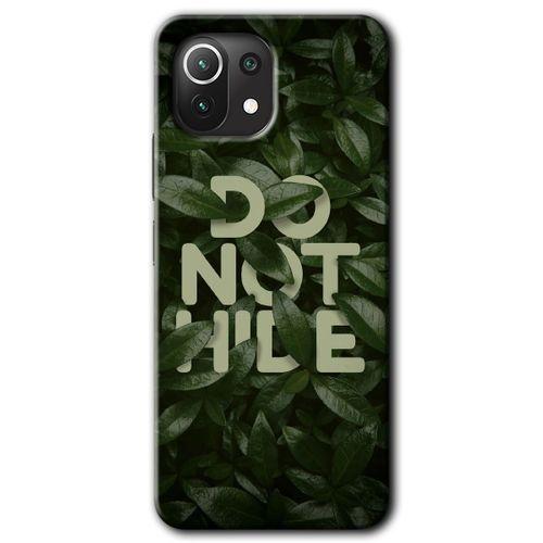 Potkal Hediye Fabrikası Xiaomi Mi 11 Lite Kılıf HD Desen Baskılı Arka Kapak - Do Not Hide