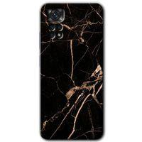 Redmi Note 11s 5G Global Kılıf HD Desen Baskılı Arka Kapak - Siyah Gold Mermer