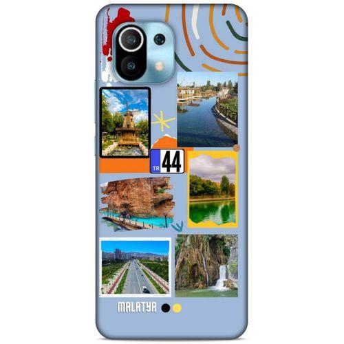 Lopard Xiaomi Mi 11 Uyumlu Kılıf Şehirli ※ (44) Tough Armor Kılıf Malatya
