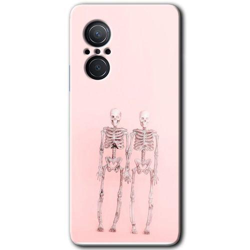 Potkal Hediye Fabrikası Huawei Nova 9 SE Kılıf HD Desen Baskılı Arka Kapak - Yaşayan Çift