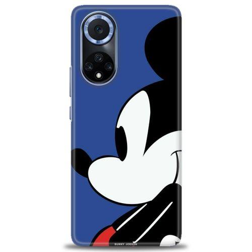 Huawei Nova 9 Kılıf HD Baskılı Kılıf - Micky Mouse + Tam Ekran Koruyucu
