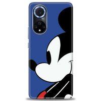 Huawei Nova 9 Kılıf HD Baskılı Kılıf - Micky Mouse + Tam Ekran Koruyucu