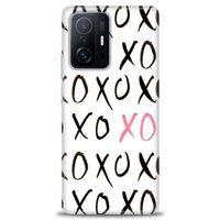 Xiaomi Mi 11T Kılıf HD Baskılı Kılıf - XOXO + Tam Ekran Koruyucu