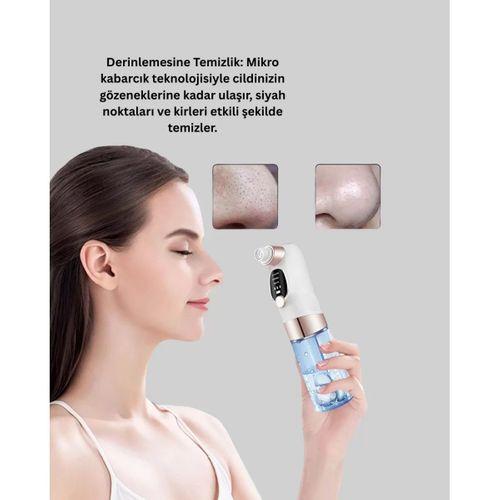 Elektrikli Siyah Nokta Sökücü – Derinlemesine Gözenek Temizleme Cihazı