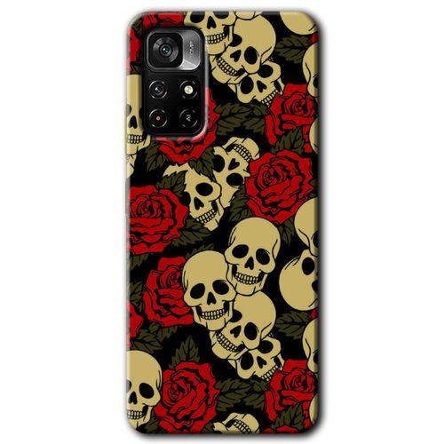 Redmi Note 11T Kılıf HD Desen Baskılı Arka Kapak - Kurukafa Aşk + Kırılmaz Cam