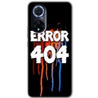 Huawei Nova 9 Kılıf HD Desen Baskılı Arka Kapak - 404 Error