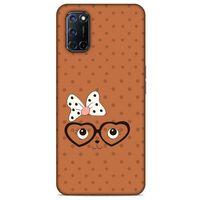 Lopard Oppo A92 Uyumlu Kılıf Kediler (11) Tam Koruma Gözlük Yüz