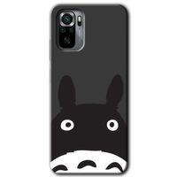 MRCİLETİSİM Xiaomi Redmi Note 10s Kılıf HD Desen Baskılı Arka Kapak + Temperli Cam - Şaşkın Eşek