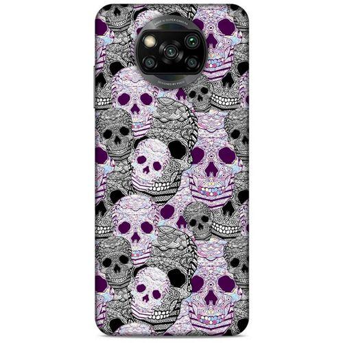 Xiaomi Redmi Poco X3 Uyumlu Kılıf Pembe Delisi (38) Neo Hybrid Kılıf Skeleton