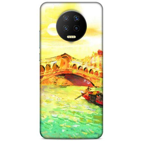 Lopard İnfinix Note 7 Uyumlu Kılıf Citiyx (13) Silikon Kap